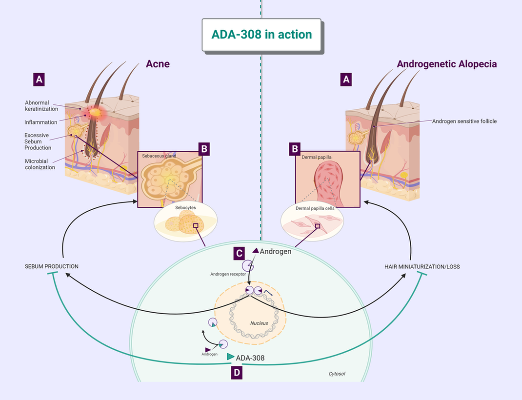 Mechanism of action for ADA-308 in acne and androgenetic alopecia (AGA)